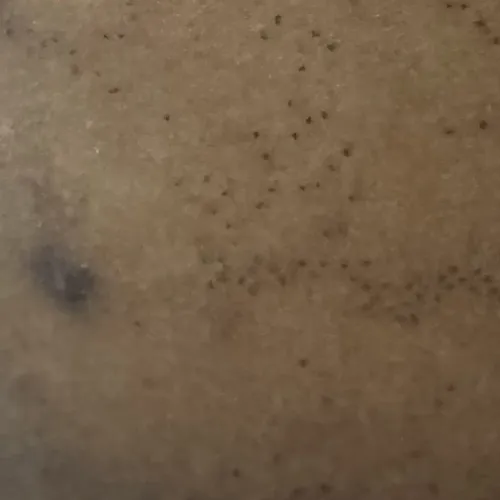 Vibha skin, hair and laser cli