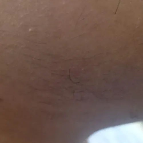 Vibha skin, hair and laser cli