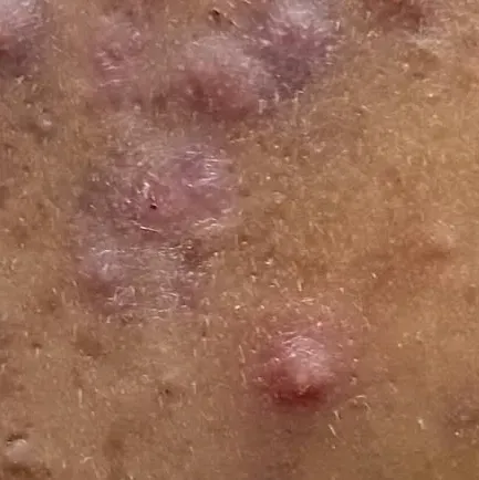Vibha skin, hair and laser cli