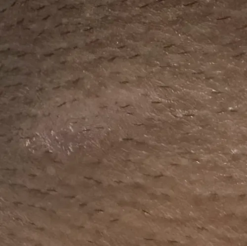 Dr.s.Valarmathi, a skin doctor