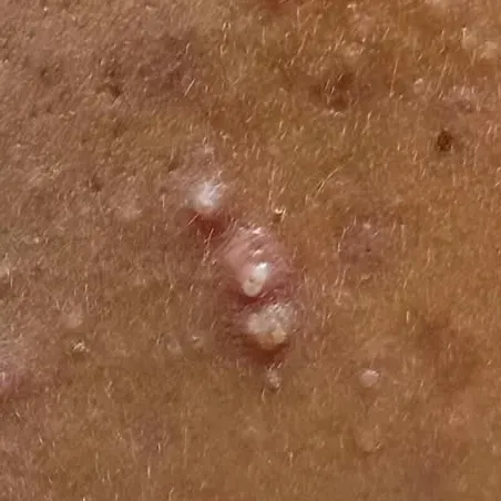 Vibha skin, hair and laser cli