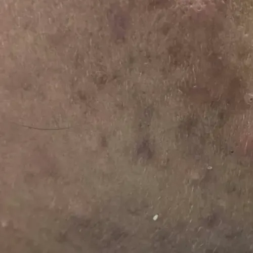 Vibha skin, hair and laser cli