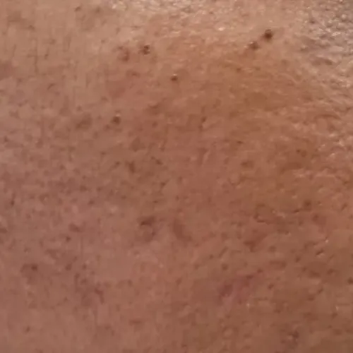 Vibha skin, hair and laser cli