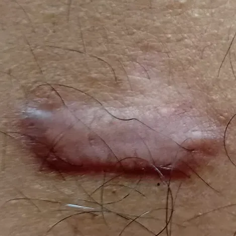 Vibha skin, hair and laser cli