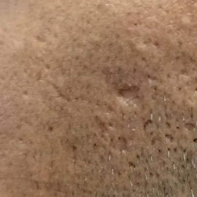 Vibha skin