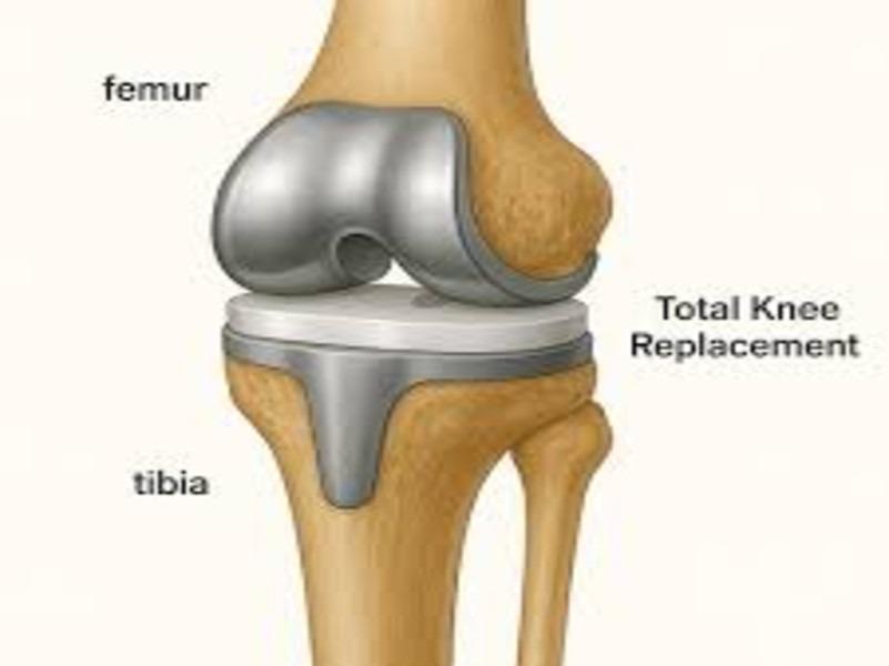 best physiotherapy treatment f