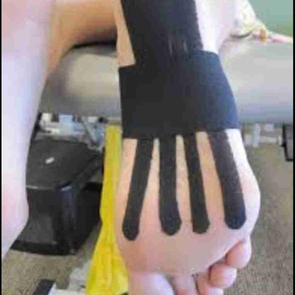 rehabilitative exercises for a