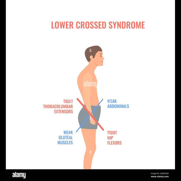 core stabilization exercises b
