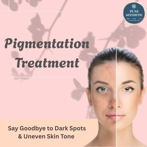 melasma and dark spot treatmen