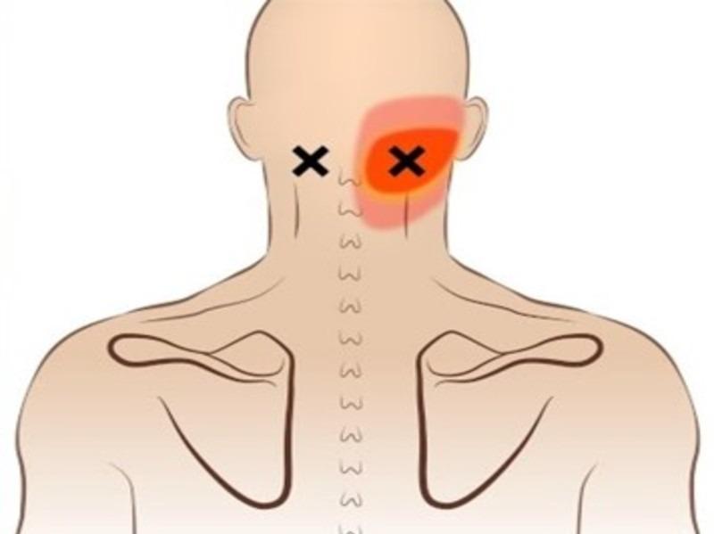 posture correction for neck di
