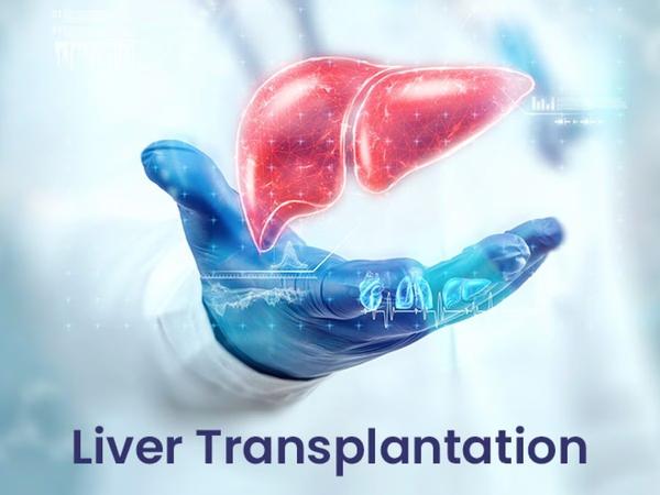 update image