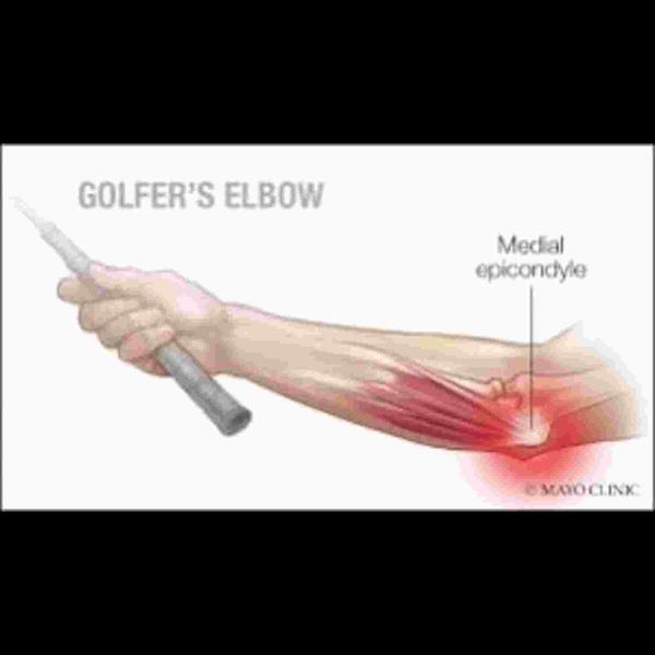 ergonomic posture correction f