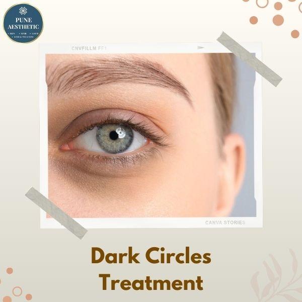 advanced dark circle treatment