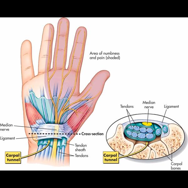 splinting and stretching exerc