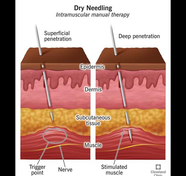 brief physiotherapists