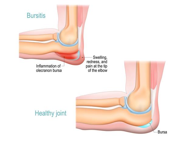 small fluid filled sacs