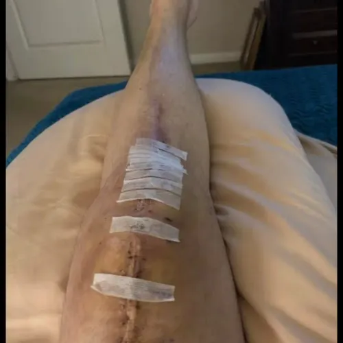 update image